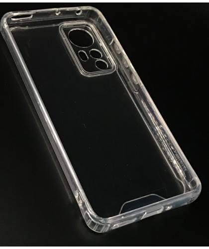 Funda Gel Xiaomi 12 -12S 12X